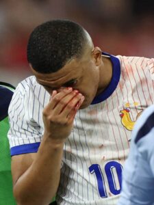 Kylian Mbappe Broke His Nose and France Could Barely Beat Austria in the Euro Cup
